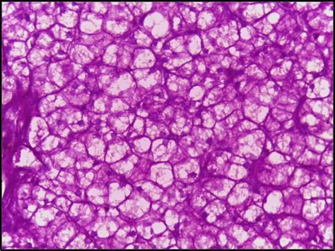 Periodic acid-Schiff (PAS) Staining: Principle, Procedure, and Application • Microbe Online