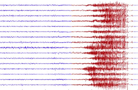 EEG Neurofeedback: Application in ADHD and Epilepsy – Resource Center