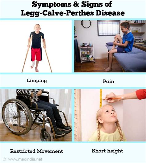 Legg-Calvé-Perthes Disease - Childhood Bone Disorder
