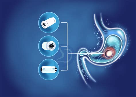 Capsule Endoscopy Nashville- Digestive & Liver Health Specialists