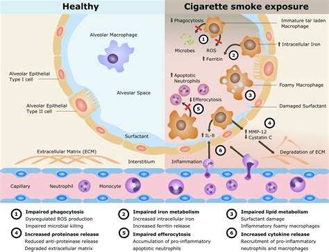 Cigarette smoke exposure and alveolar macrophages: mechanisms for lung disease | Thorax