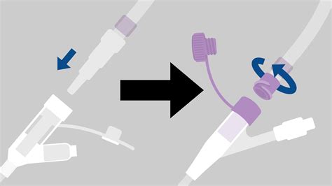 ENFit connectors are becoming the industry standard for safer tube feeding connections | Coram ...