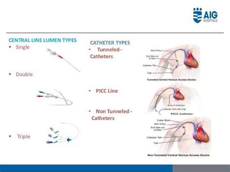 Non Tunneled Central Venous Catheter