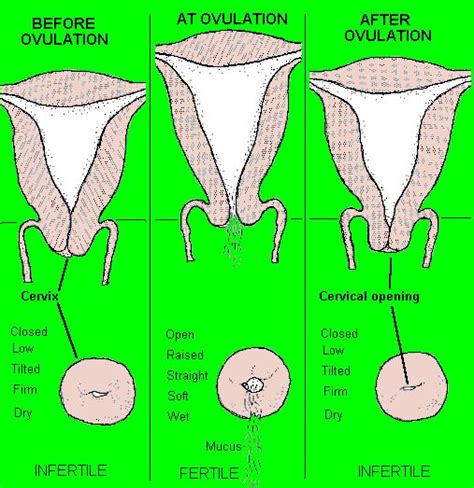 Explain The Warning Signs Of A Boggy Or Soft Uterus