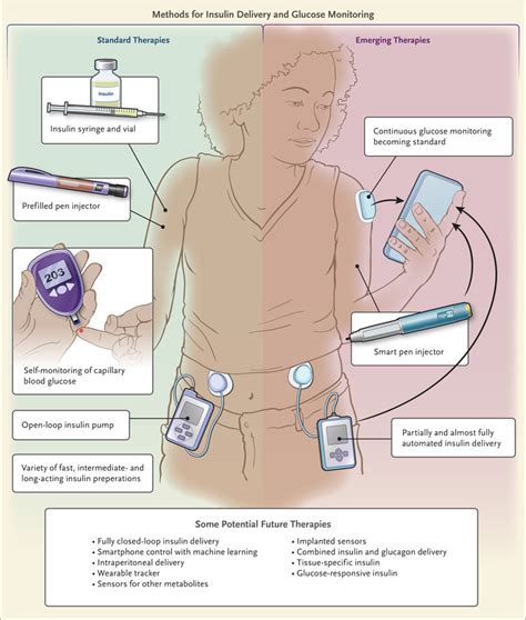 Current Management of Glycemia in Children with Type 1 Diabetes Mellitus | NEJM