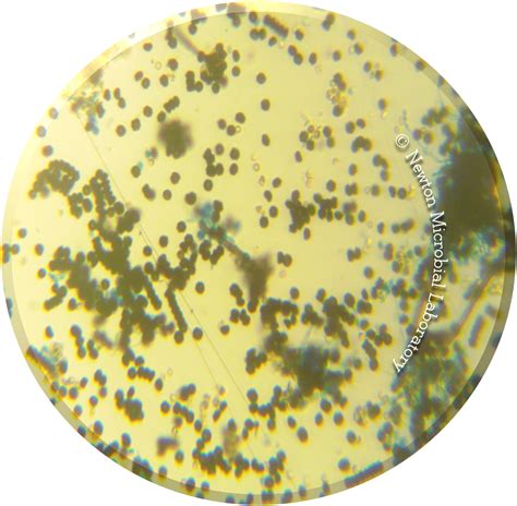 Black Mold Pictures, under the microscopes | Mold Awareness