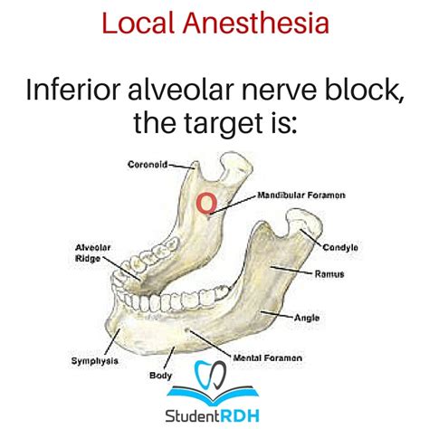 Inferior Alveolar Nerve Block - slidesharetrick