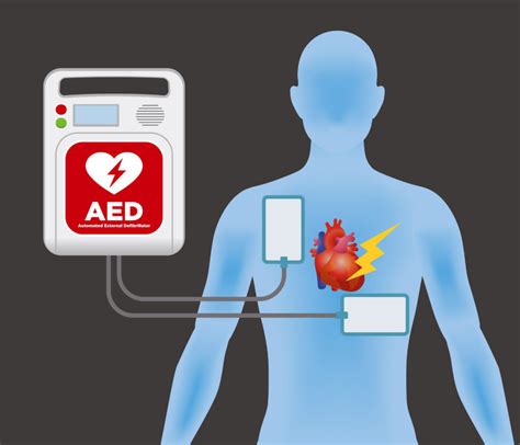 EMC CPR Training | How to Purchase an AED