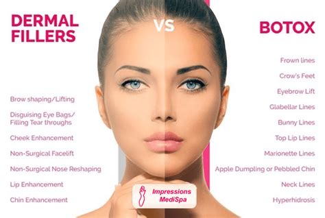 Botox And Fillers - Green Bay - Ambiance Md Medical Spa for Dummies ...