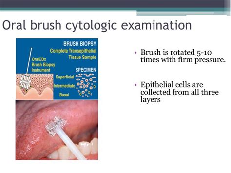 PPT - Principles of Differential diagnosis and BIOPSY PowerPoint Presentation - ID:1951886