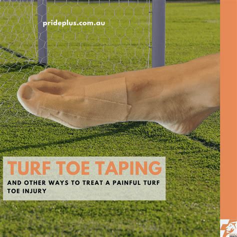 Turf Toe Taping & Injury Treatment | Get You Back On Your Feet