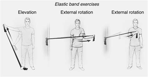 Bands - Shoulder & Elbow