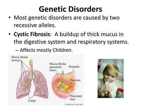 PPT - Genetic Disorders, Karyotypes , & Pedigrees PowerPoint Presentation - ID:3066042