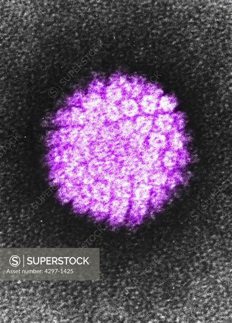 Electron micrograph of a negatively stained human papilloma virus (HPV) which occurs in human ...