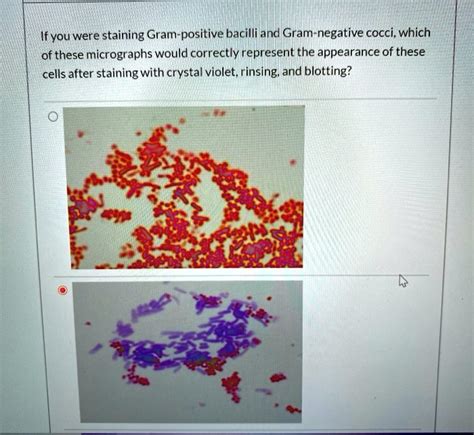 Ifyou were staining Gram-positive bacilli and Gram-negative cocci, which of these micrographs ...