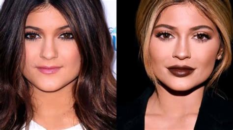 13 of the most drastic celebrity plastic surgeries | Celebrity plastic ...