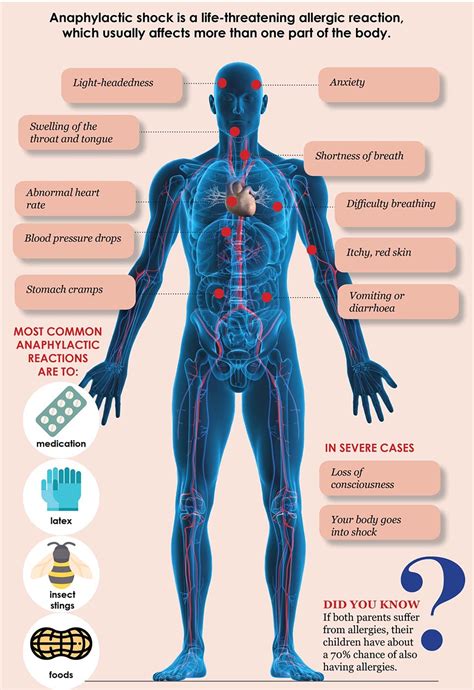 Researchers identified a new pathological mechanism responsible for anaphylactic shock - https ...