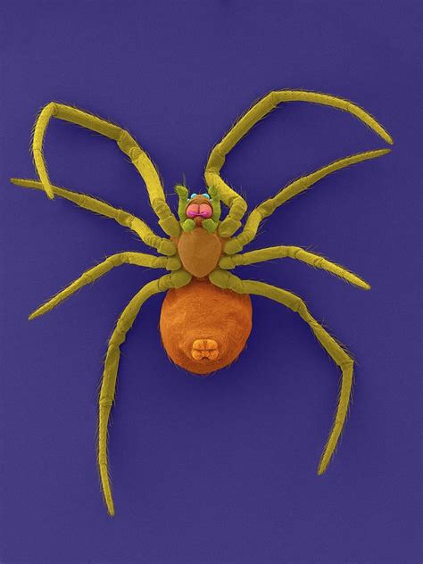 Western Black Widow Spiderling Photograph by Dennis Kunkel Microscopy/science Photo Library ...