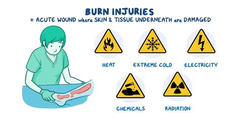 Burn injury: Nursing - Osmosis Video Library