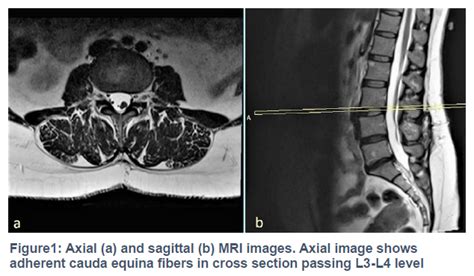 A15-Fig1