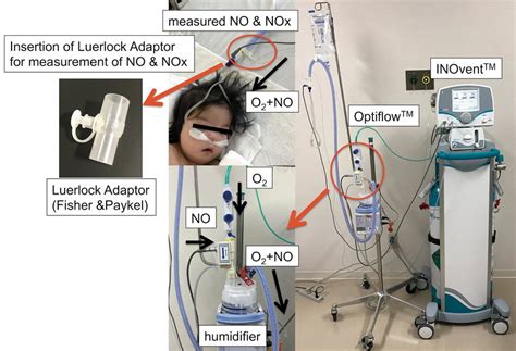 Setup for combining inhaled nitric oxide therapy with oxygen therapy... | Download Scientific ...