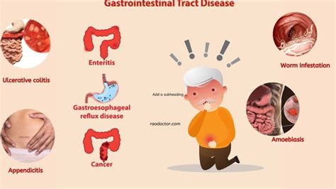 11 Gastro-intestinal [GI] Diseases For You To Know - Patientparadise