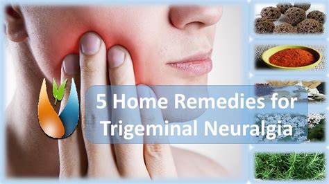 Trigeminal Neuralgia Face Pain