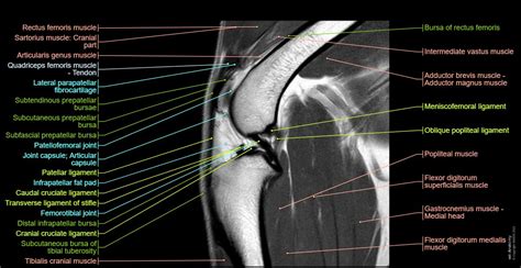 Stifle joint anatomy of the dog on MRI - normal anatomy | vet-Anatomy