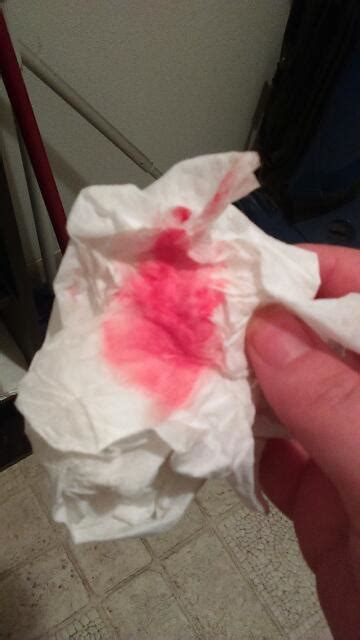 Please say this is implantation bleeding! It is bright pink as you can ...