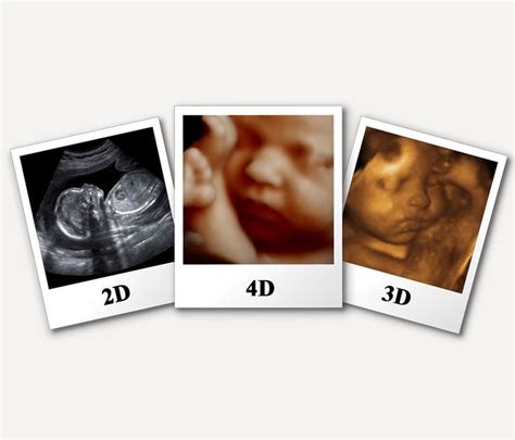 Pin on 3D and 4D ultrasound