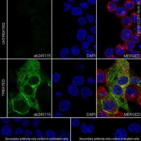 Dendritic Cell Marker (CD103, LY75/DEC-205, TLR7, DC-SIGN + DC-SIGNR ...