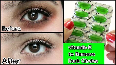 Glycerin And Vitamin E For Dark Circles