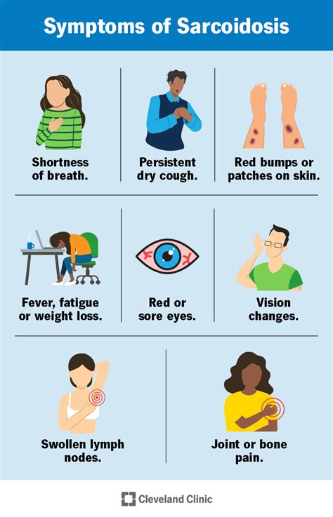 Sarcoidosis: Causes, Symptoms, Diagnosis & Treatment