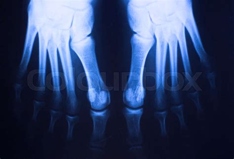 Medical xray foot scan | Stock image | Colourbox