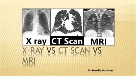 X-ray VS CT scan VS MRI.pptx | Free Download