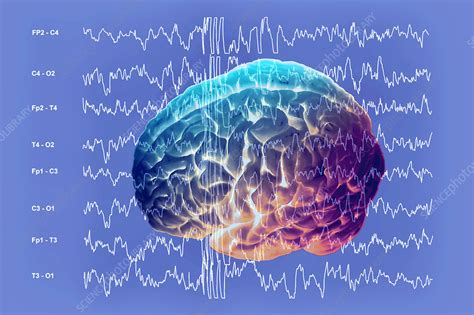 Brain and brain waves in epilepsy - Stock Image - M150/0279 - Science ...