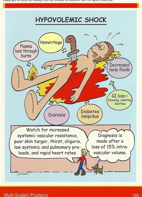 Hypovolemia