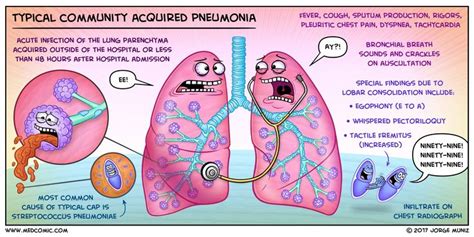 Community acquired pneumonia Community acquired pneumonia (CAP) is an ...