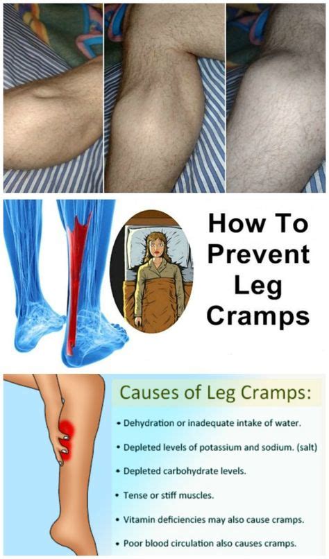 Leg cramps also have another name, Charley horse. They are spasms that make you wake up at night ...