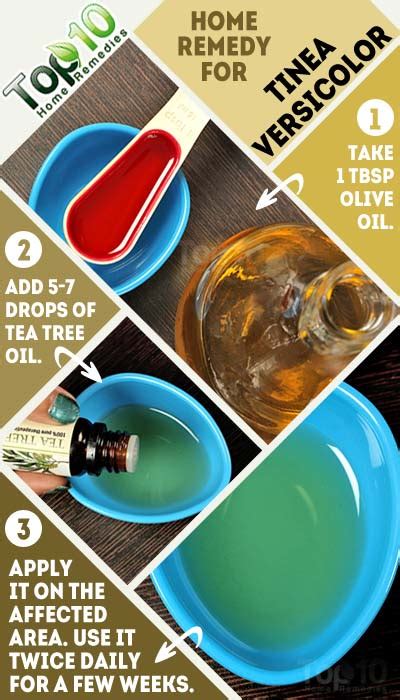 Home Remedies for Tinea Versicolor | Top 10 Home Remedies