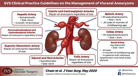 The Society for Vascular Surgery clinical practice guidelines on the management of visceral ...