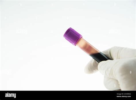 Vacutainer EDTA blood collection tubes Stock Photo - Alamy