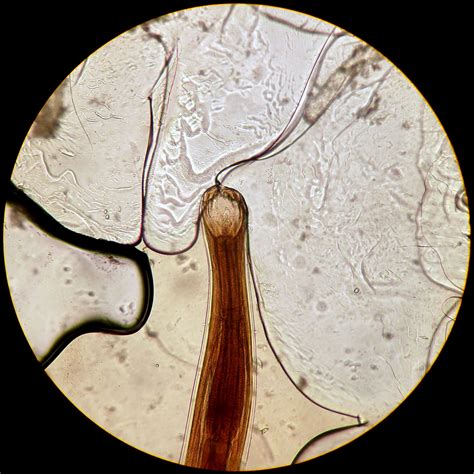 76 Best Of Ancylostoma Duodenale Teeth - insectza