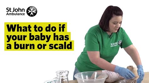 What to do if Your Baby has a Burn or Scald - First Aid Training - St John Ambulance - YouTube