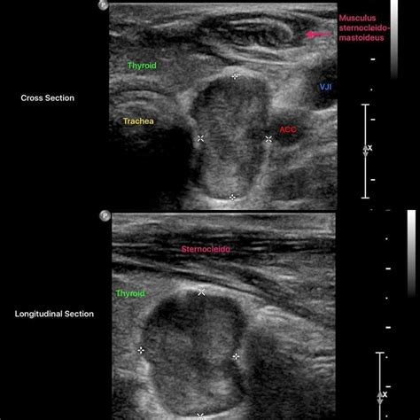 Pin on Sonography