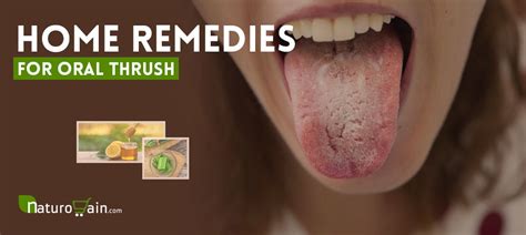 7 Best Home Remedies for Dry Mouth - Xerostomia Natural Relief