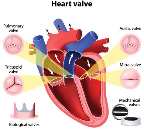 Mitral Valve Disease | Dr. Peter Mikhail - Tampa, Clearwater, Florida