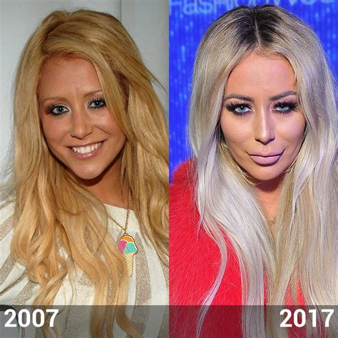 Aubrey O'Day Before and After: Did the Star Have Plastic Surgery?