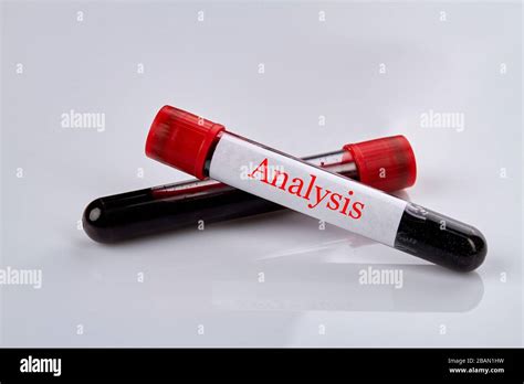 Blood test analysis Stock Photo - Alamy