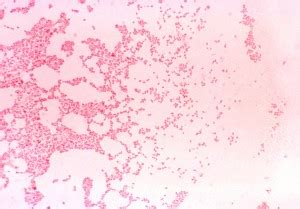 Free picture: photomicrograph, bacteria, brucella melitensis, cells